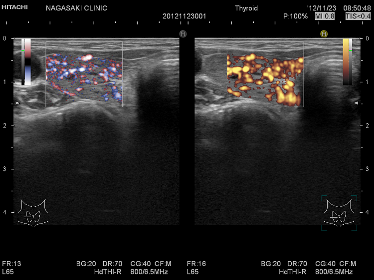 eFlow(イー フロー)とパワードプラーの比較 eFlow(イー フロー)とパワードプラーの比較
