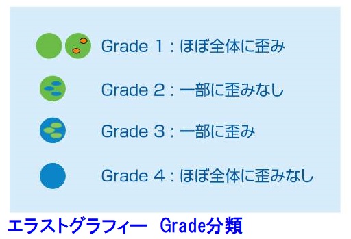 エラストグラフィー grade分類 エラストグラフィー grade分類