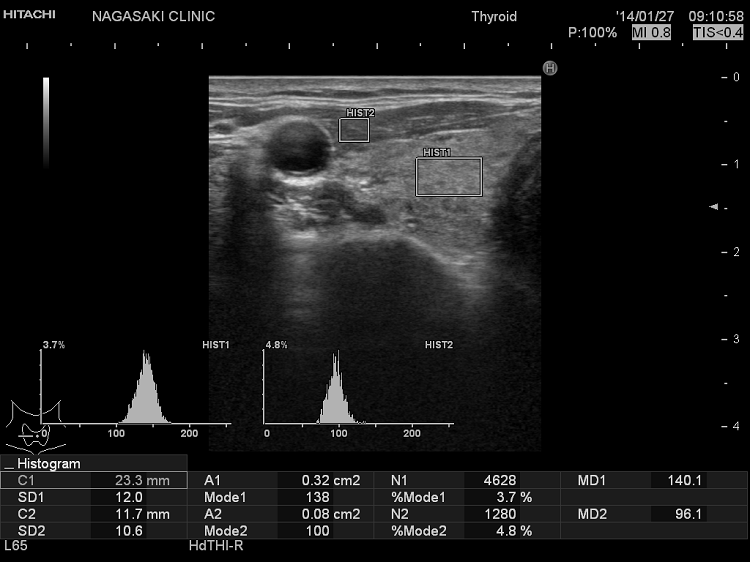 グレースケール解析 グレイスケール解析