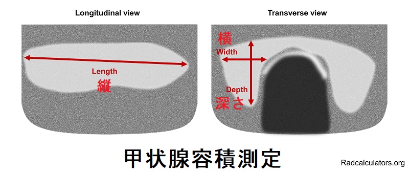 甲状腺容積測定 甲状腺容積測定