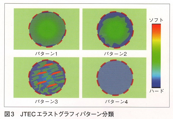 JTEC エラストグラフィーパターン JTEC エラストグラフィーパターン