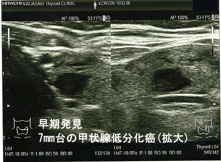 甲状腺・頸部の超音波診断   /金芳堂/小西淳二（単行本） 甲状腺・頸部の超音波診断 - 株式会社 金芳堂