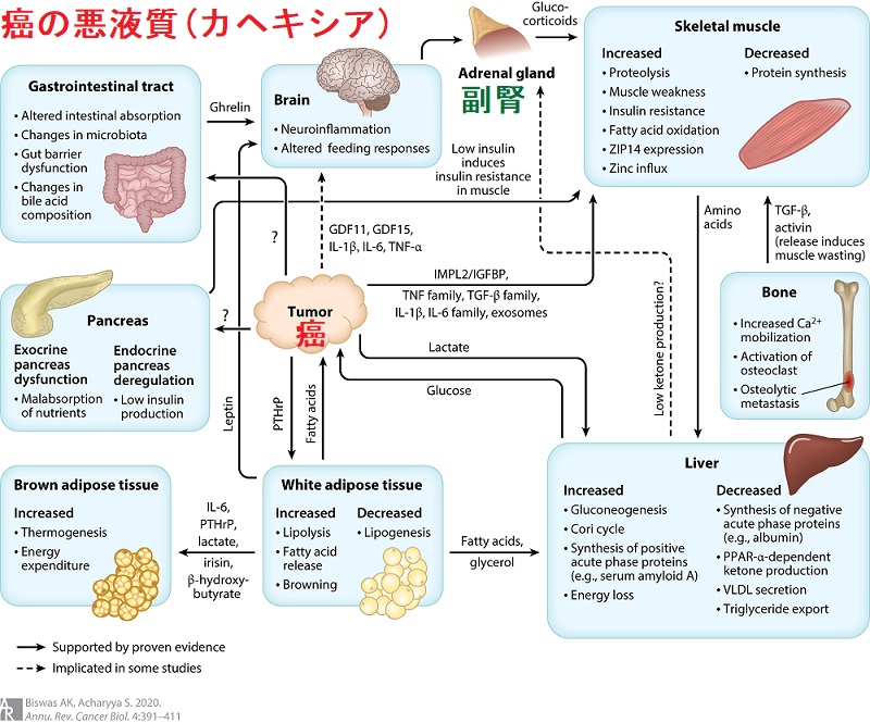 癌の悪液質(カヘキシア:Cachexia) 癌の悪液質(カヘキシア:Cachexia)
