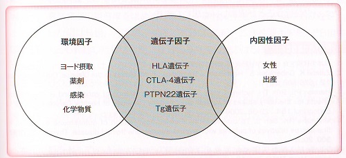 橋本病(慢性甲状腺炎)の原因 橋本病(慢性甲状腺炎)の原因