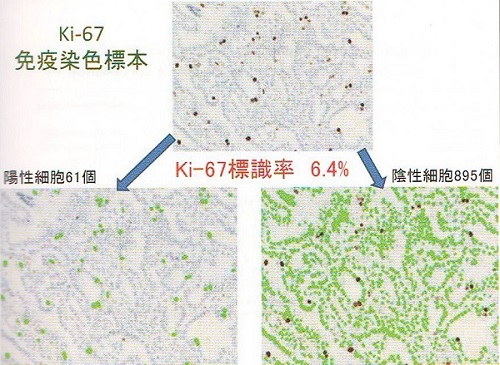 MIB-1(Ki-37標識率)ラベリング 方法 MIB-(Ki-37標識率)1ラベリング 方法