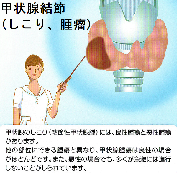 甲状腺結節(しこり、腫瘤) 甲状腺結節(しこり、腫瘤)