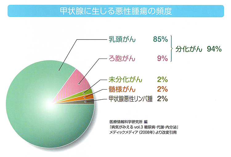 甲状腺悪性リンパ腫の頻度 甲状腺悪性リンパ腫の頻度