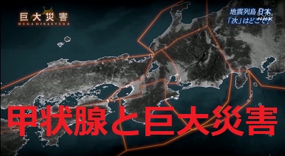 甲状腺と巨大災害 甲状腺と巨大災害