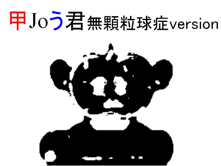 甲Joう君 無顆粒球症 甲Joう君 無顆粒球症