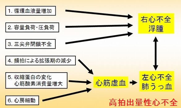 甲状腺機能亢進症/バセドウ病の心不全 甲状腺機能亢進症/バセドウ病の心不全