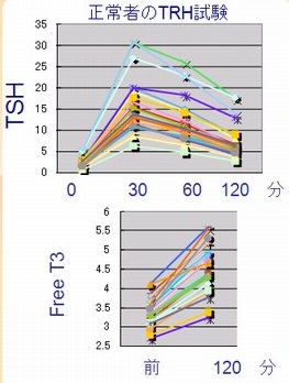 TRH(TSH放出ホルモン)負荷試験 TRH(TSH放出ホルモン)負荷試験