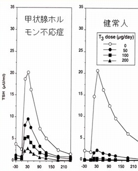 T3抑制下TRH負荷試験 甲状腺ホルモン不応症(レフェトフ症候群)の場合 T3抑制下TRH負荷試験 甲状腺ホルモン不応症(レフェトフ症候群)の場合