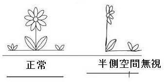 半側空間無視 半側空間無視
