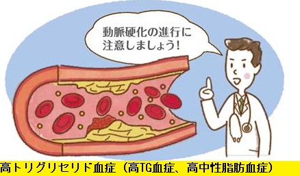 高トリグリセリド血症(高TG血症、高中性脂肪血症)で動脈硬化 高トリグリセリド血症(高TG血症、高中性脂肪血症)で動脈硬化