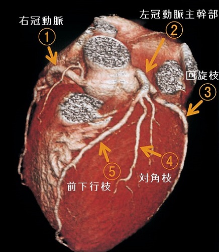 冠状動脈 冠状動脈