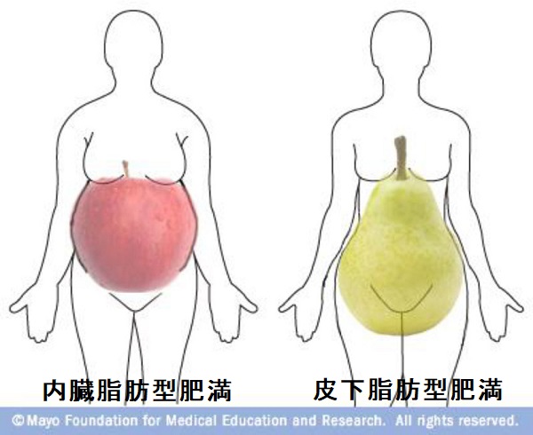 肥満症とメタボリック症候群・内臓脂肪[橋本病 バセドウ病