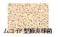 ムコイド型肺炎球菌 ムコイド型肺炎球菌