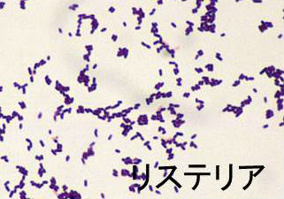リステリア リステリア
