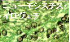 Pneumocystis jirovecii Pneumocystis jirovecii