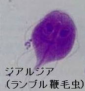 ランブル鞭毛虫 (ジアルジア症) ランブル鞭毛虫 (ジアルジア症)