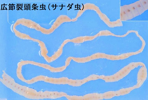 広節裂頭条虫(サナダ虫) 広節裂頭条虫(サナダ虫)