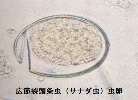 広節裂頭条虫(サナダ虫)の虫卵 広節裂頭条虫(サナダ虫)の虫卵