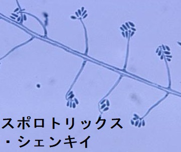 スポロトリックス・シェンキイ スポロトリックス・シェンキイ