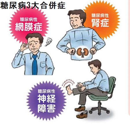 糖尿病3大合併症 糖尿病3大合併症