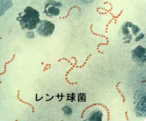 レンサ球菌 レンサ球菌