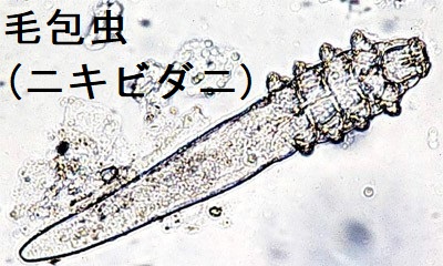 毛包虫(ニキビダニ) 毛包虫(ニキビダニ)