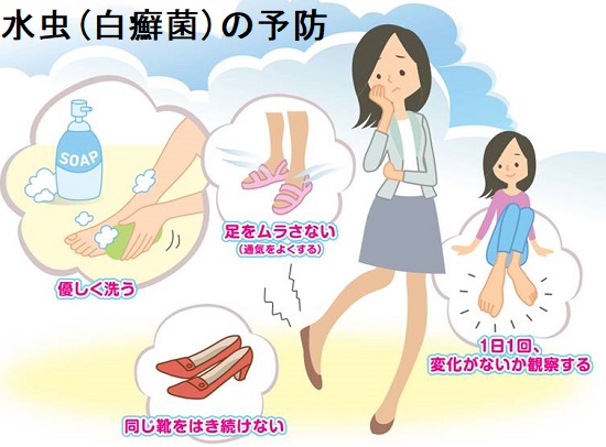 水虫(白癬菌) 水虫(白癬菌)