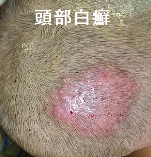 頭部白癬 頭部白癬