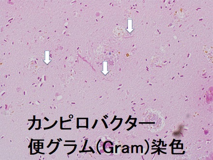 カンピロバクター 便グラム(Gram)染色 カンピロバクター 便グラム(Gram)染色