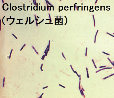 Clostridium perfringens(ウェルシュ菌) Clostridium perfringens(ウェルシュ菌)
