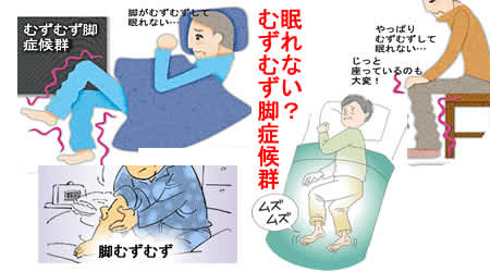 むずむず脚症候群(レストレスレッグ症候群) むずむず脚症候群(レストレスレッグ症候群)