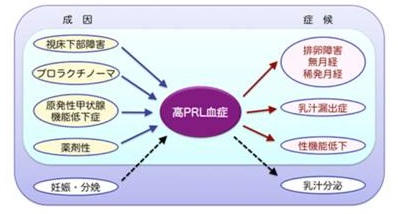 高プロラクチン血症の原因 高プロラクチン血症の原因