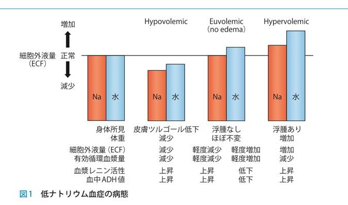 低ナトリウム(Na)血症鑑別 低ナトリウム(Na)血症鑑別