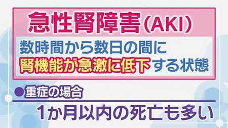 急性腎障害(AKI) 急性腎障害(AKI)
