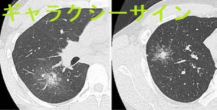 ギャラクシーサイン ギャラクシーサイン