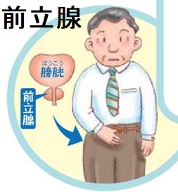 前立腺肥大症と前立腺がん 前立腺肥大症と前立腺がん
