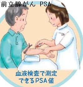 前立腺がん PSA 前立腺がん PSA