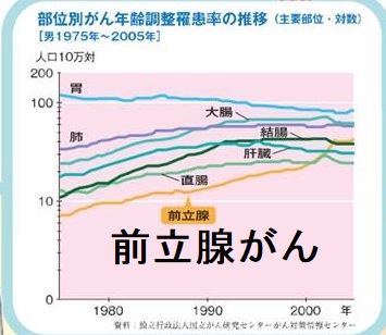 前立腺がん 前立腺がん