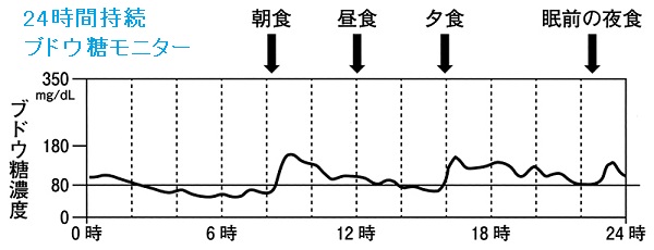 インスリノーマ 24時間持続ブドウ糖モニター インスリノーマ 24時間持続ブドウ糖モニター