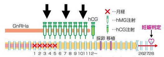 採卵前の頻回注射(FSH/hMG) 採卵前の頻回注射(FSH/hMG)