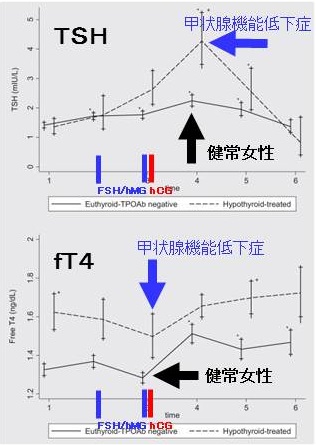 FSH/hMG、hCG注射後のTSH上昇、FT4低下 FSH/hMG、hCG注射後のTSH上昇、FT4低下