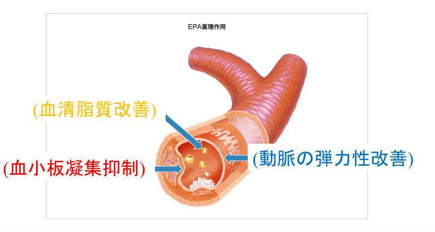 エイコサペンタエン酸(EPA)製剤 作用 エイコサペンタエン酸(EPA)製剤 作用