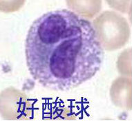 甲状腺機能亢進症/バセドウ病と好酸球増加症 甲状腺機能亢進症/バセドウ病と好酸球増加症