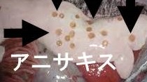アニサキス アニサキス