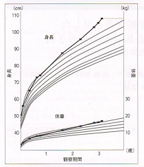 幼児甲状腺機能亢進症/バセドウ病 過成長・骨年齢促進 幼児甲状腺機能亢進症/バセドウ病 過成長・骨年齢促進