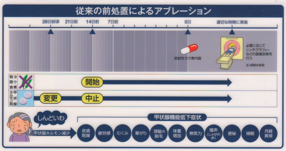 I-131 アブレーション治療 従来法 I-131 アブレーション治療 従来法